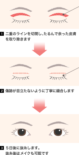 当院の手術方法と特徴とは