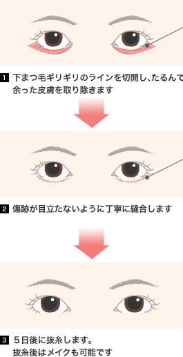 当院の手術方法と他院との違いとは？