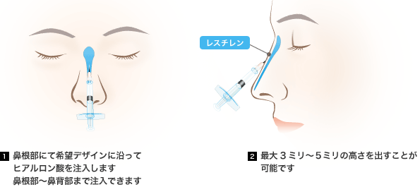 当院の手術方法と特徴